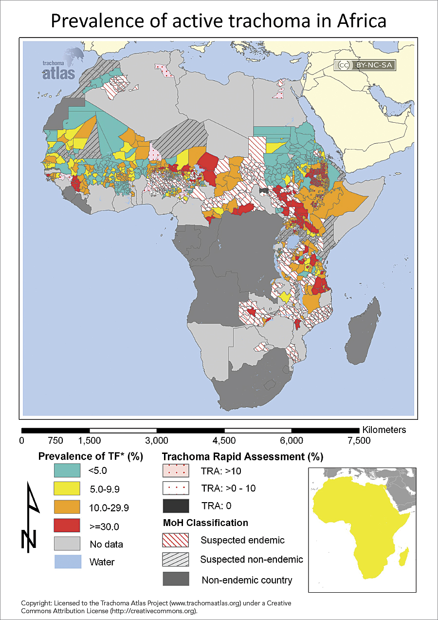 This map of Africa from www.trachomaatlas.org illustrates the known distribution of trachoma and the data gaps across the continent.